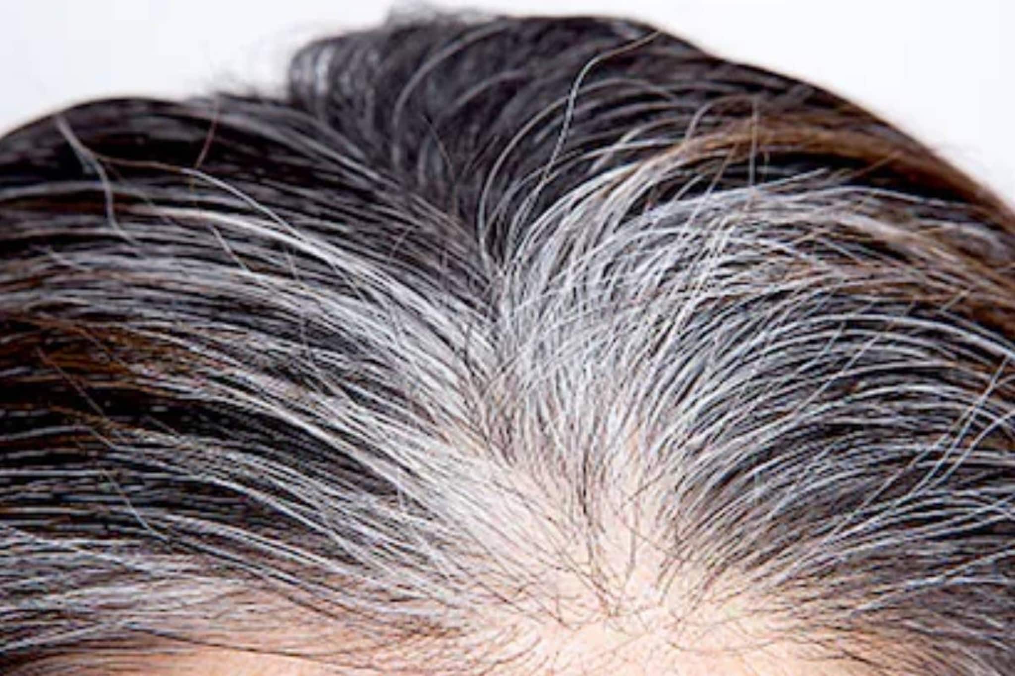 পাকা চুল কালো করতে হেয়ার ডাই নয়, ভরসা রাখুন তেল-এ! জেনে নিন কোন তেলে চুল হবে কুচকুচে কালো পাকা চুল কালো করতে হেয়ার ডাই নয়, ভরসা রাখুন তেল-এ! জেনে নিন কোন তেলে চুল হবে কুচকুচে কালো