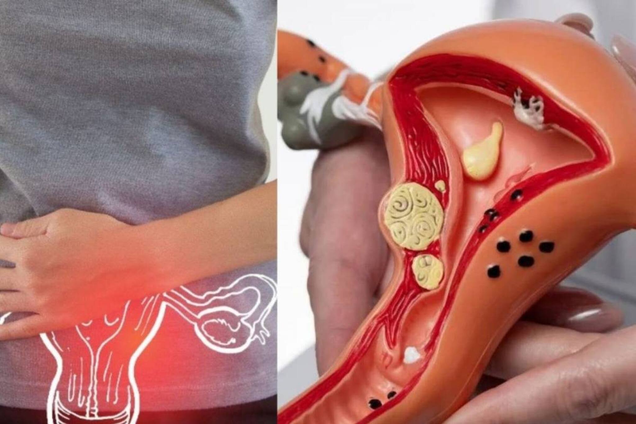 মহিলাদের প্রজননের ২ জটিল রোগ! শেষ করে দিতে পারে জীবনের সব স্বপ্ন! জানুন লক্ষণ