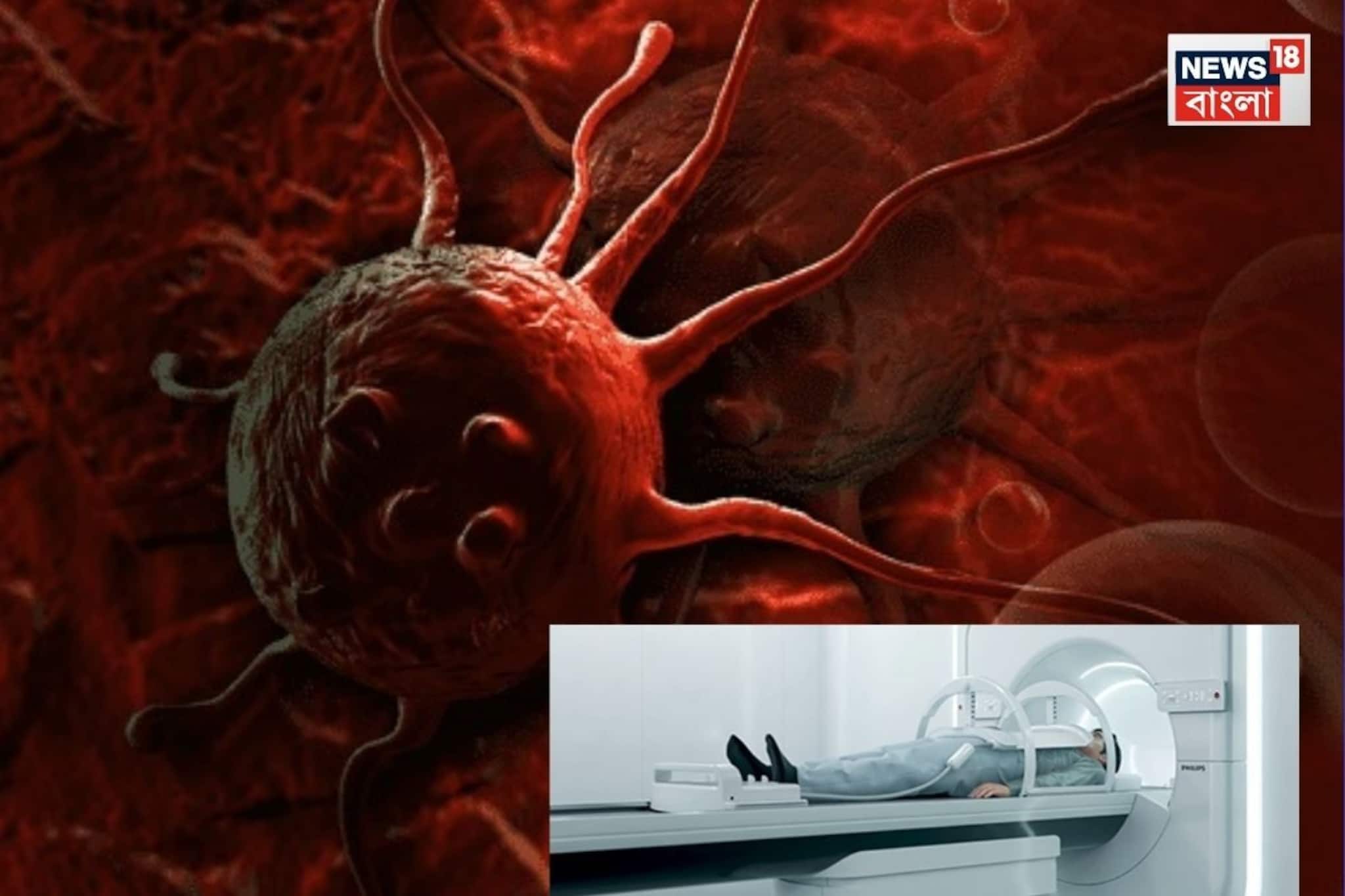 ক্যানস্যার চিকিৎসায় আরও উন্নতি!ভারতে প্রথম তৈরি হল MR Linac মেশিন,মিলবে তাড়াতাড়ি মুক্তি