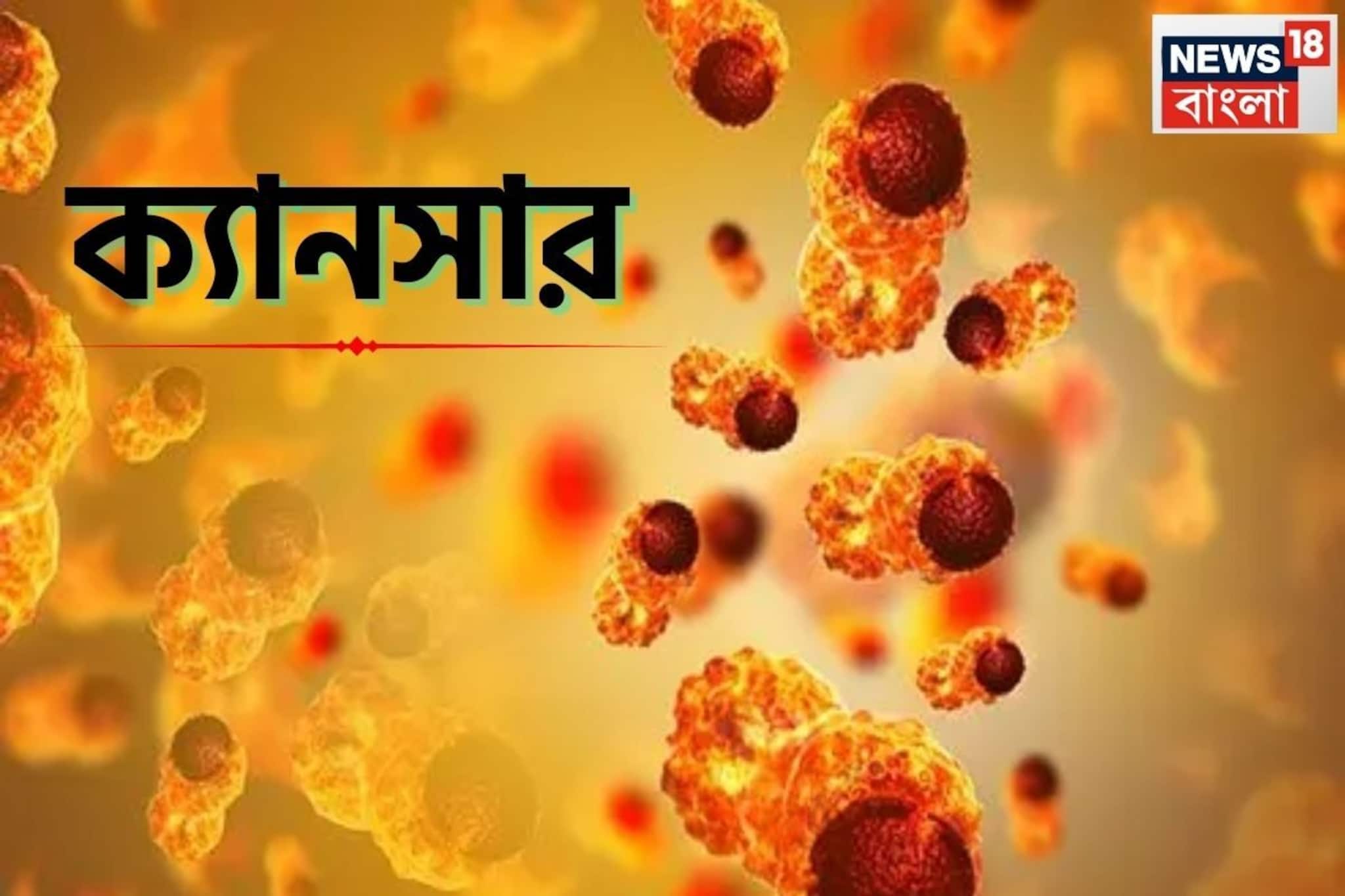১৫ খাবার...! বাড়িয়ে দেয় 'ক্যানসারের' ঝুঁকি, রোজ রোজ খাচ্ছেন নাকি? চমকে দেবে 'গবেষণা'