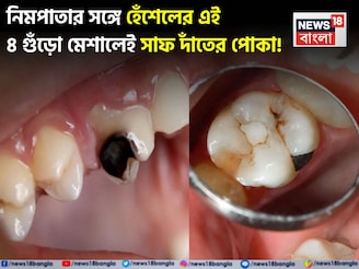 নিমপাতার সঙ্গে হেঁশেলের এই ৪ গুঁড়ো মিশিয়ে মাজুন! সাফ মুখের গন্ধ, পোকা খাওয়া দাঁতের গর্ত