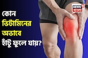 কোন ভিটামিনের অভাবে হাঁটু ফুলে যায়? কোন ভিটামিন না খেলে অসহ্য ব্যথা হয় হাঁটুতে? জেনে নিন