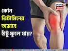 কোন ভিটামিনের অভাবে হাঁটু ফুলে যায়? কোন ভিটামিন না খেলে অসহ্য ব্যথা হয় হাঁটুতে? জেনে নিন