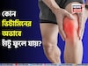 কোন ভিটামিনের অভাবে হাঁটু ফুলে যায়? কোন ভিটামিন না খেলে অসহ্য ব্যথা হয় হাঁটুতে? জেনে নিন