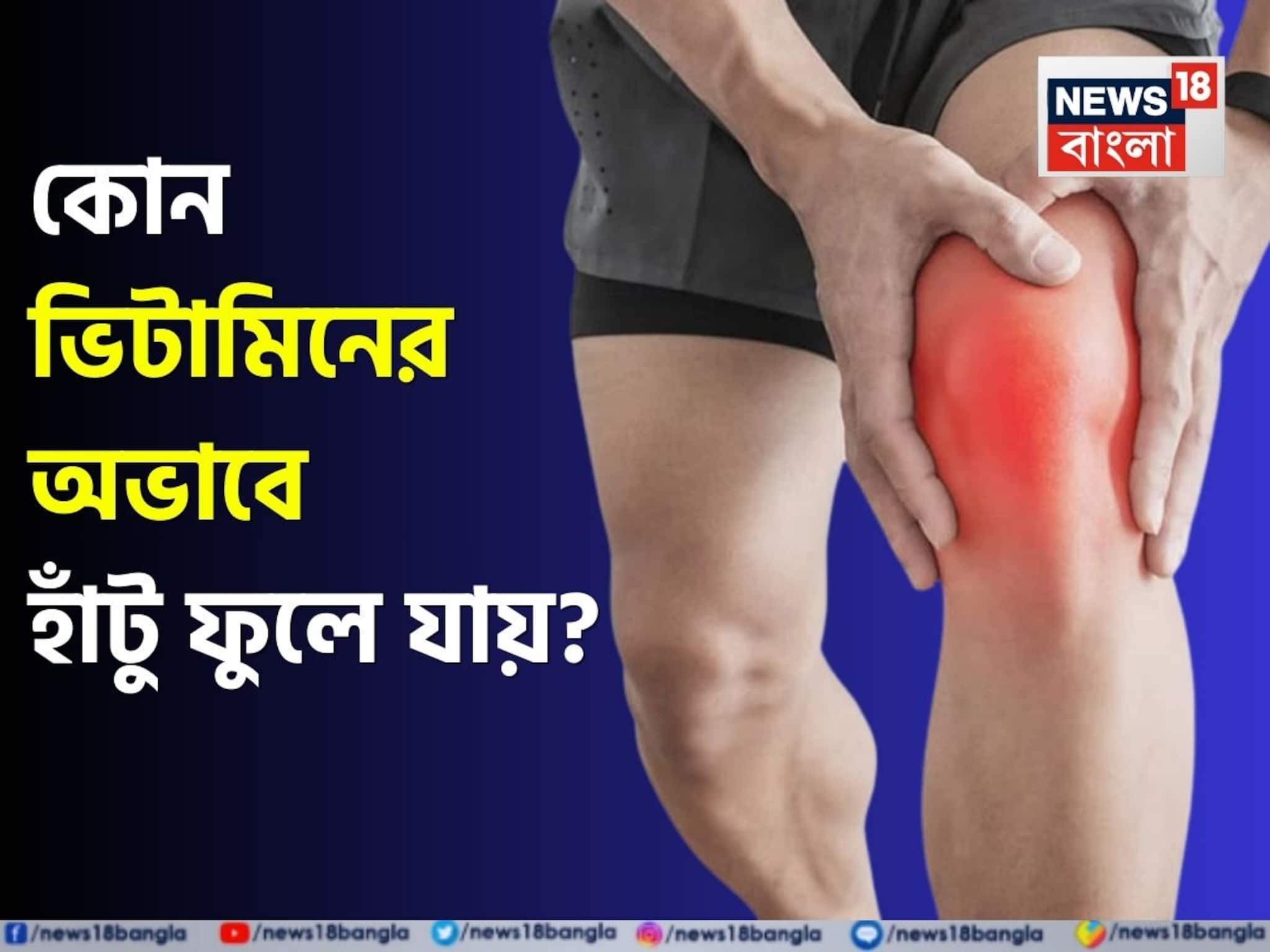 Vitamin & Knee Swelling: কোন ভিটামিনের অভাবে হাঁটু ফুলে যায়? কোন ভিটামিন না খেলে অসহ্য ব্যথা হয় হাঁটুতে? জানুন হাঁটুর জন্য কী খাবেন, কী খাবেন না