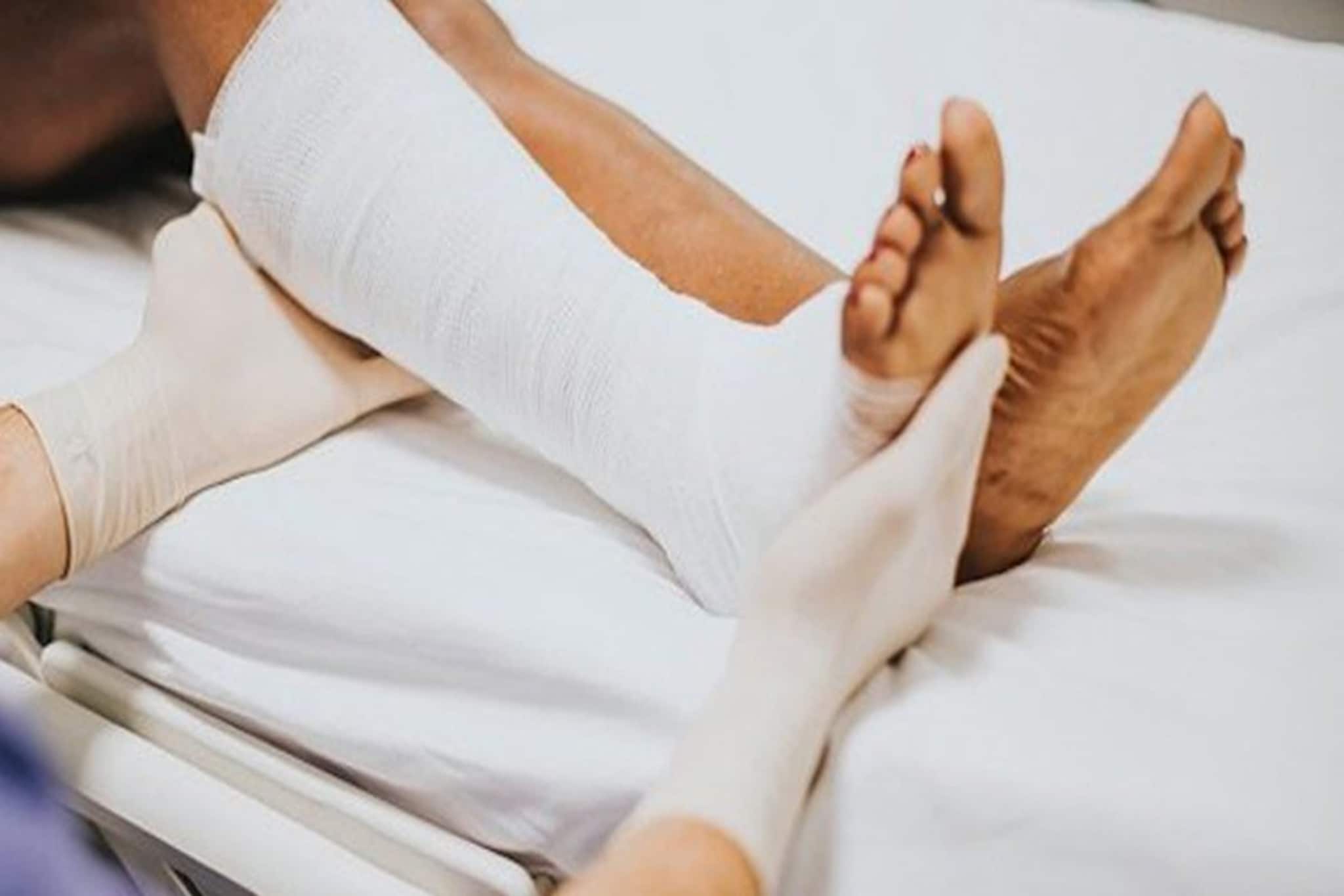 প্লাস্টার বা রডের ঝক্কি নেই! এবার তিন মিনিটেই আঠা দিয়ে জুড়ে যাবে ভাঙা হাড়!