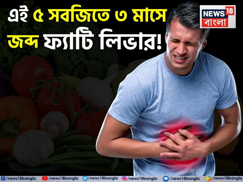  ব্লাড সুগারে কিছু ফল অত্যন্ত সতর্কতার সঙ্গে খাওয়া উচিত। বিশেষ করে যদি আপনি ইনসুলিন সংবেদনশীলতা বা ডায়াবেটিসে ভুগছেন, তাহলে ফল-সহ অন্যান্য খাবারের বিষয়েও বিশেষ সাবধানতা নিতে হবে। বলছেন নিউজার্সির এন্ডোক্রিনোলজিস্ট ডঃ অ্যালেসিয়া রোহেনেল্ট৷