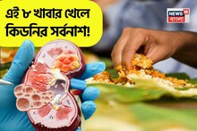 চুপিসারে পচন ধরবে! ধীরে ধীরে ভরবে পাথরে! এই ৮ খাবার জলখাবারে খেলে কিডনির চরম সর্বনাশ!