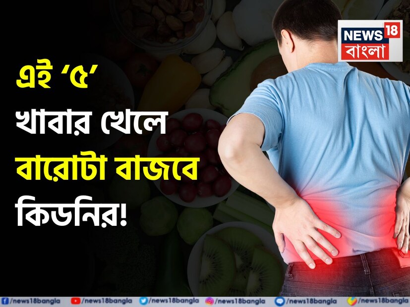 তরুণদের মধ্যে কিডনি ব্যর্থতার ক্রমবর্ধমান ঘটনা সরাসরি তাঁদের খাদ্যাভ্যাসের পছন্দের সঙ্গে সম্পর্কিত। নির্দিষ্ট খাবার নিয়মিত খাওয়ার ফলে এই গুরুত্বপূর্ণ অঙ্গগুলির উপর দীর্ঘস্থায়ী চাপ পড়ে এবং কিডনির ক্ষতি হয়। বিপজ্জনক খাবার সম্পর্কে জ্ঞান, কিডনির উপর তাদের নির্দিষ্ট প্রভাব সহ, মানুষকে তাদের স্বাস্থ্য রক্ষা করতে সক্ষম করে। এখানে পাঁচটি খাবারের তালিকা দেওয়া হল যা বিশেষজ্ঞরা তরুণদের মধ্যে কিডনি ব্যর্থতার হার বৃদ্ধির সঙ্গে যুক্ত করেছেন। বলছেন কিডনি বিশেষজ্ঞ বেঙ্কটরামন চন্দ্রশেখর৷