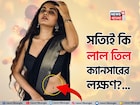 শরীরের লাল তিল কী ক্যানসারের লক্ষণ? বড় তথ্য এল সামনে, না জানলে বিপদে পড়বেন