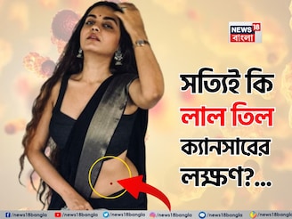 শরীরের লাল তিল কী ক্যানসারের লক্ষণ? বড় তথ্য এল সামনে, না জানলে বিপদে পড়বেন