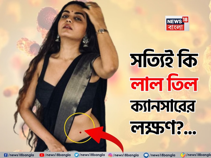 ত্বকের ক্যানসার প্রতিরোধে কী করবেন: সর্বদা আপনার ত্বকের যত্ন সহকারে পর্যবেক্ষণ করুন। বিদ্যমান দাগ, দাগ, ফুসকুড়ি, তিল ইত্যাদির কোনও পরিবর্তন আছে কিনা তা পরীক্ষা করুন। নতুন বা পরিবর্তিত তিলগুলির দিকে নজর রাখুন। সানস্ক্রিন ব্যবহার করুন। যদি আপনার কোনও সন্দেহ থাকে, তাহলে অবিলম্বে একজন ডাক্তারের সাথে পরামর্শ করুন।