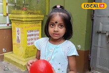 বিরল রোগে আক্রান্ত চিনপাই গ্রামের আরাধ্যা, চিকিৎসার খরচে অসহায় পরিবার