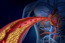 Cholesterol Control Tips: পুজোয় পাতে মটন, চিংড়ি? রাতারাতি বাড়তে পারে কোলেস্টেরল! খেয়াল রাখুন এই বিষয়গুলি, নইলে হার্ট অ্যাটাকে মুহূর্তেই চোখের সামনে অন্ধকার!