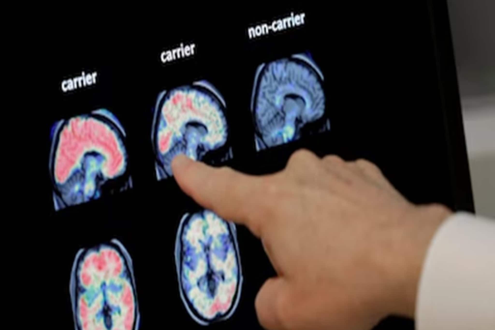 পানীয় জল থেকেও কি শরীরে প্রবেশ করে কেরলের মারণ জীবাণু? মৃত্যু হার ভয় ধরাবে