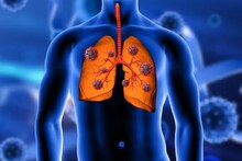 Lung Cancer: প্রাণঘাতী ফুসফুসের ক্যানসারের প্রাথমিক উপসর্গ ফুটে ওঠে আঙুলে-নখে, আঙুলের কোন লক্ষণ ক্যানসারের ইঙ্গিত দেয়? পড়ুন
