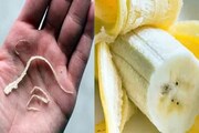 কলা খাওয়ার সময় কি কলার সুতোগুলিও খান? কলার তন্তু পেটে চলে গেলে কী হয় জানুন