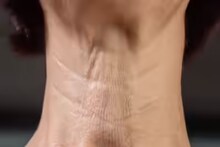 ঘাড়ে বলিরেখা পড়েছে? ঝুলে পড়ছে ত্বক? চামড়া টানটান করতে এই ৪ 'জাদুকরী' ব্যায়াম জানুন