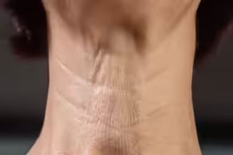 ঘাড়ে বলিরেখা পড়েছে? ঝুলে পড়ছে ত্বক? চামড়া টানটান করতে এই ৪ 'জাদুকরী' ব্যায়াম জানুন