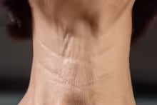 Neck Wrinkles Prevention: ঘাড়ে বলিরেখা পড়েছে? ঝুলে পড়ছে ত্বক?  চামড়া টানটান করতে এই ৪ 'জাদুকরী' ব্যায়ামের টিপস, হুড়মুড়িয়ে কমবে বয়স!