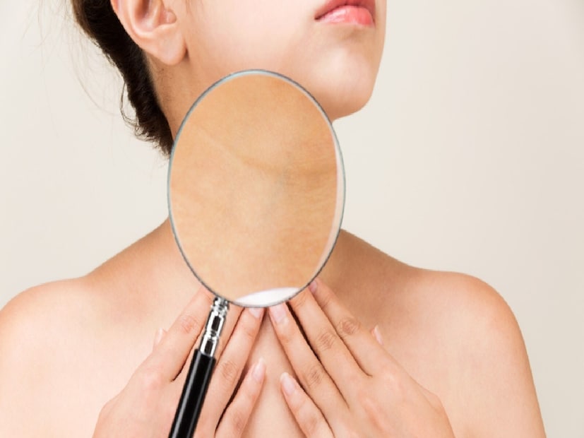 চিবানোর ব্যায়াম-- ঘাড়ের দৃঢ়তা উন্নত করার আরেকটি কার্যকর উপায় হল চিবানোর ব্যায়াম। সোজা হয়ে বসতে হবে এবং মাথা পিছনে কাত করতে হবে, যাতে থুতনি উপরের দিকে থাকে। ঠোঁট না খুলে, ২০ বার চিবানোর ধরন অনুকরণ করতে হবে। 