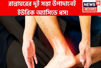 বহু বছরের ইউরিক অ্যাসিডের ব্যথা যন্ত্রণার ইতি! রান্নাঘরের দুই অতি সস্তার উপাদানেই ঘায়েল