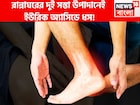 বহু বছরের ইউরিক অ্যাসিডের ব্যথা যন্ত্রণার ইতি! রান্নাঘরের দুই অতি সস্তার উপাদানেই ঘায়েল