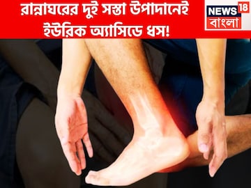 বহু বছরের ইউরিক অ্যাসিডের ব্যথা যন্ত্রণার ইতি! রান্নাঘরের দুই অতি সস্তার উপাদানেই ঘায়েল বহু বছরের ইউরিক অ্যাসিডের ব্যথা যন্ত্রণার ইতি! রান্নাঘরের দুই অতি সস্তার উপাদানেই ঘায়েল