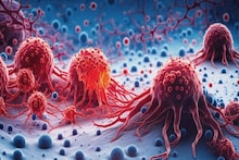 Cancer Reason: ক্যানসারে আক্রান্ত এত মানুষ, ক্যানসার হওয়ার মূল কারণ নিয়ে চিকিৎসকদের বক্তব্য জানুন, সতর্ক হোন