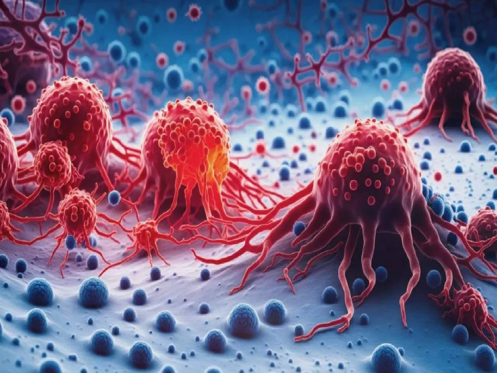 Cancer Reason: ক্যানসারে আক্রান্ত এত মানুষ, ক্যানসার হওয়ার মূল কারণ নিয়ে চিকিৎসকদের বক্তব্য জানুন, সতর্ক হোন