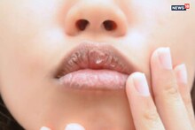 Lip Care Tips: শীত আসার আগেই ঠোঁট ফাটছে? জ্বলছে? এই কাজেই ঠোঁট থাকবে তুলোর মতো তুলতুলে!