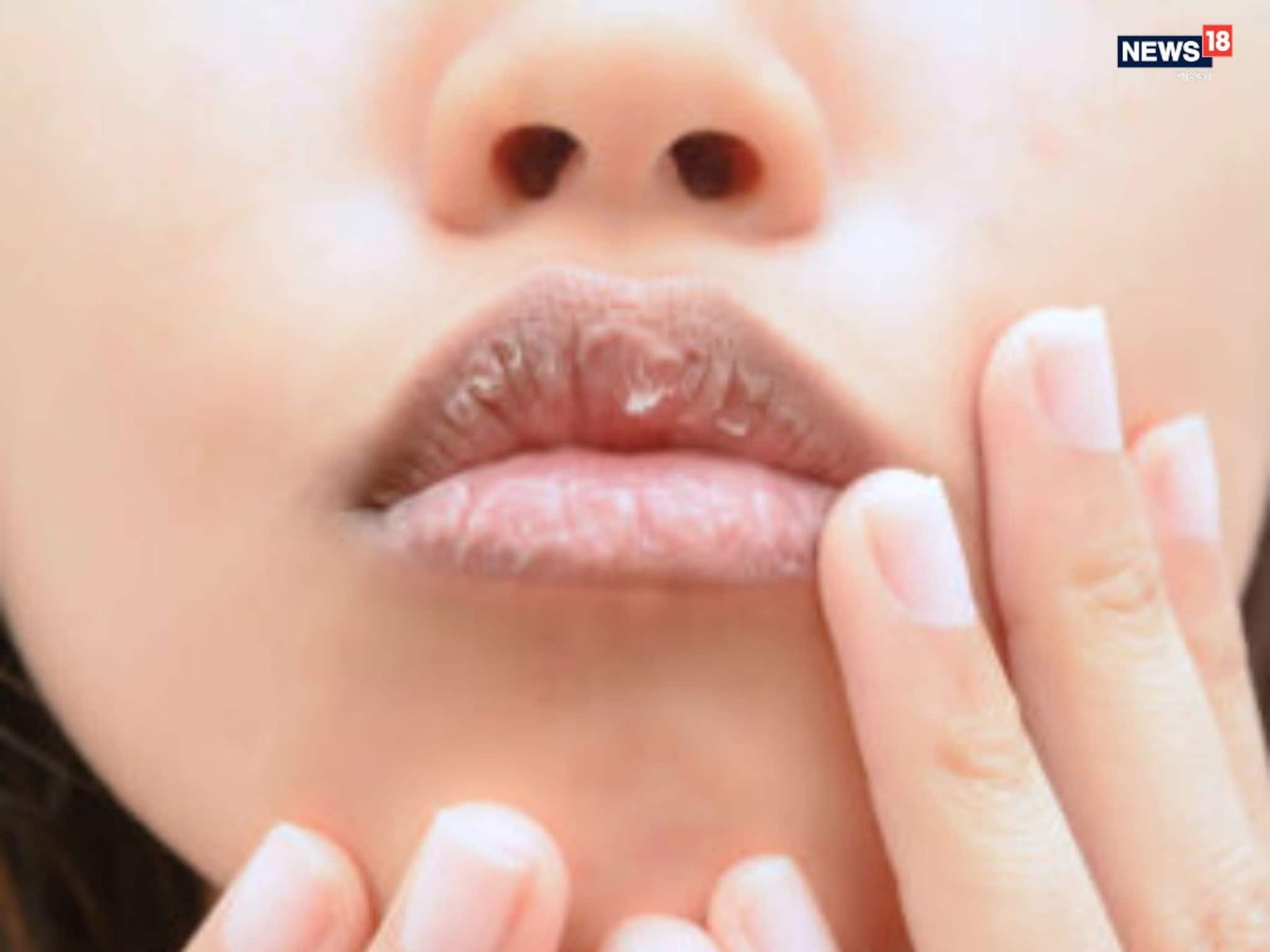 Lip Care Tips: শীত আসার আগেই ঠোঁট ফাটছে? জ্বলছে? এই কাজেই ঠোঁট থাকবে তুলোর মতো তুলতুলে!