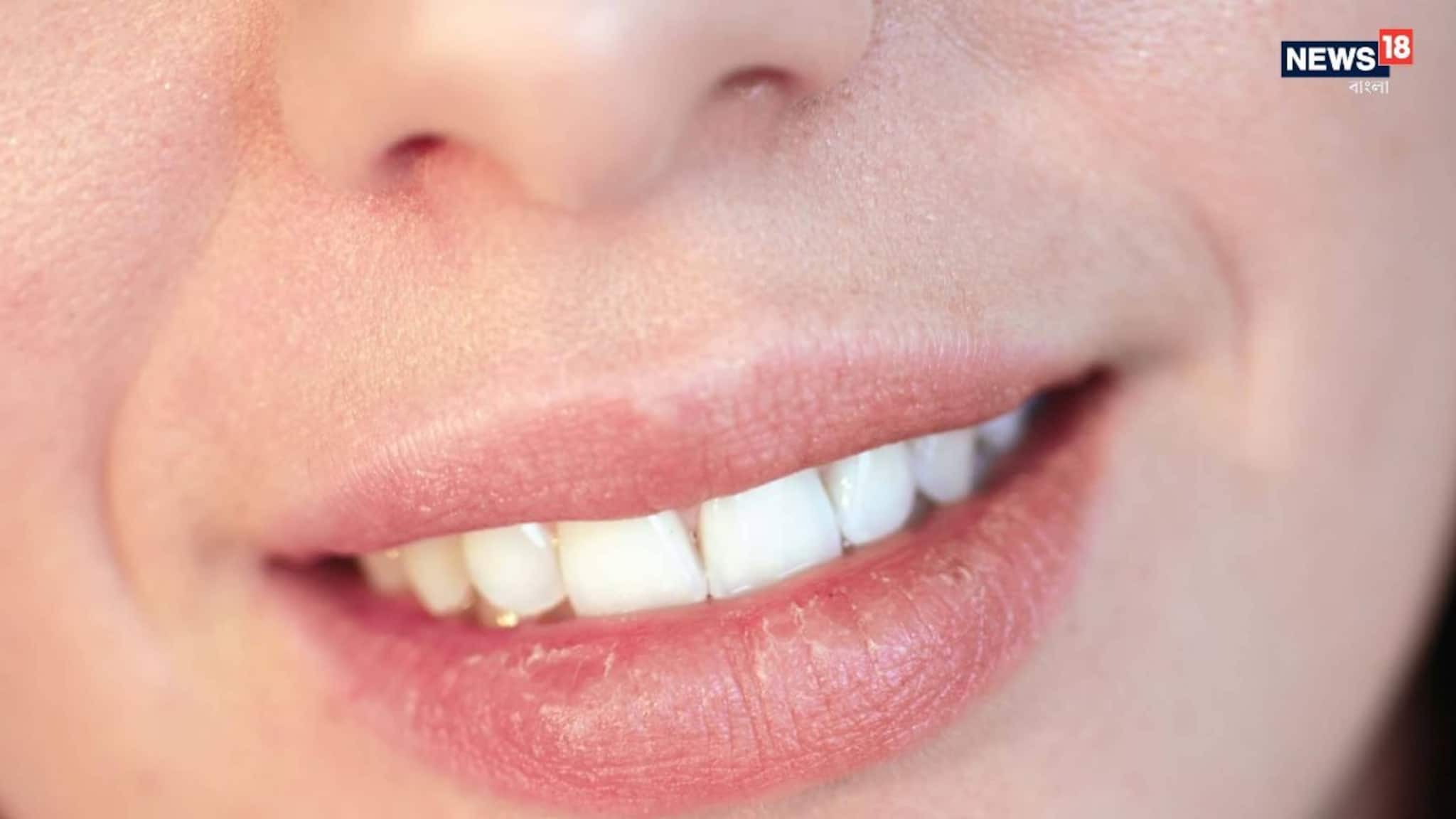 নাক এবং ঠোঁটের মাঝের অংশকে কী বলে  ৯৯ শতাংশই জানে না, এই অংশেরও আছে এক বিশেষ নাম