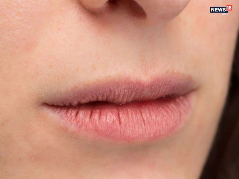 এই পদ্ধতিগুলি সম্পূর্ণ প্রাকৃতিক, ব্যবহার করা সহজ এবং ক্ষতিকারক নয়। তাহলে, আসুন জেনে নেওয়া যাক কীভাবে এই শীতে শুষ্ক এবং ফাটা ঠোঁট নরম রাখবেন...