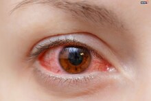 Eye Care Easy Tips: দীপাবলি-ছটের আতসবাজি থেকে চোখে সমস্যা, গুরুতর আঘাত, ক্রমবর্ধমান উদ্বেগের প্রেক্ষাপটে সঙ্গে রাখুন বিশেষজ্ঞের পরামর্শ