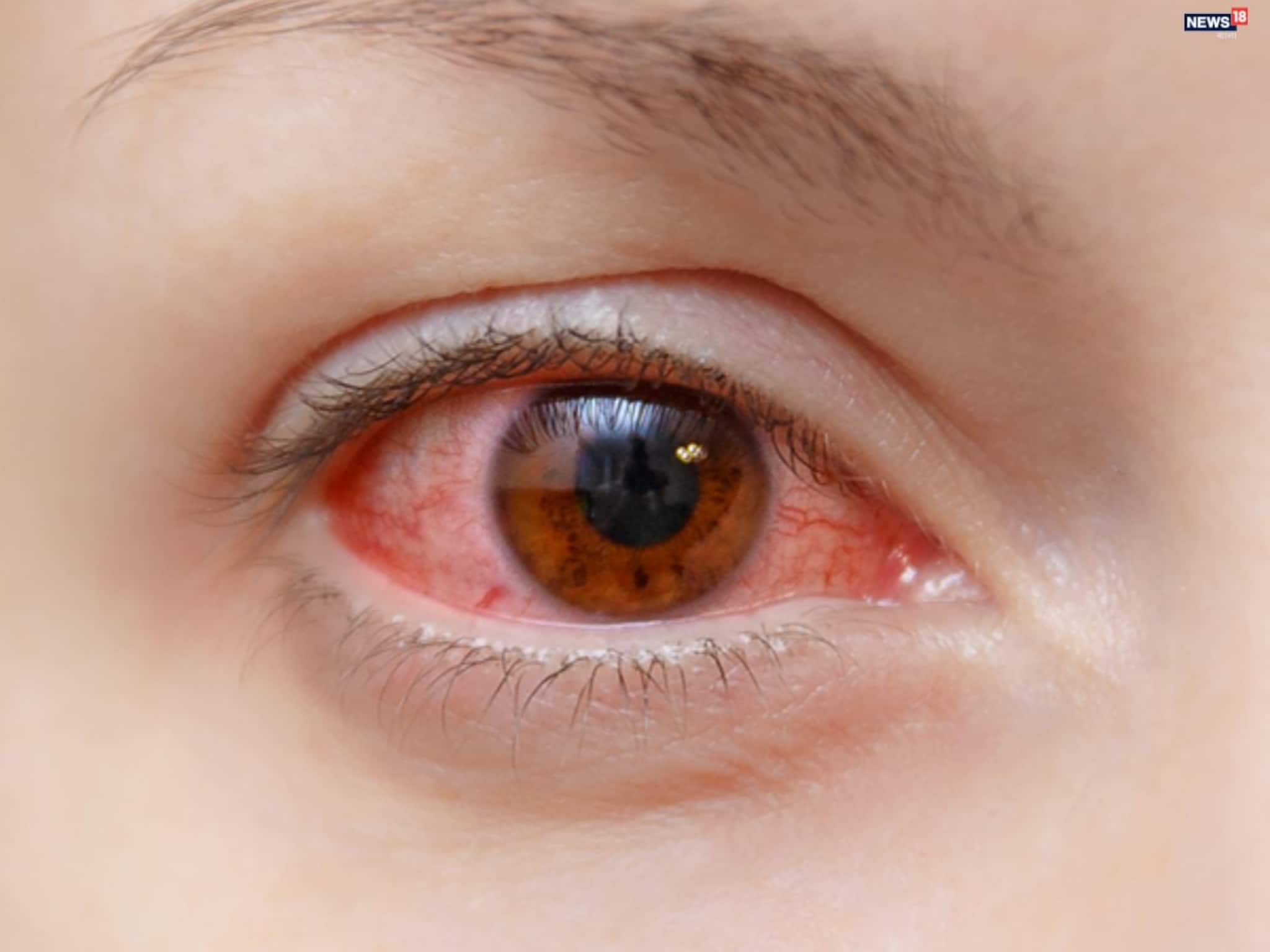 Eye Care Easy Tips: দীপাবলি-ছটের আতসবাজি থেকে চোখে সমস্যা, গুরুতর আঘাত, ক্রমবর্ধমান উদ্বেগের প্রেক্ষাপটে সঙ্গে রাখুন বিশেষজ্ঞের পরামর্শ Eye Care Easy Tips: দীপাবলি-ছটের আতসবাজি থেকে চোখে সমস্যা, গুরুতর আঘাত, ক্রমবর্ধমান উদ্বেগের প্রেক্ষাপটে সঙ্গে রাখুন বিশেষজ্ঞের পরামর্শ