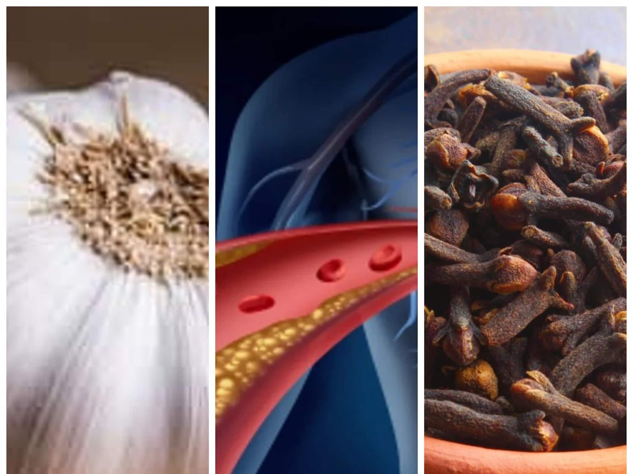 Cholesterol & Heart Disease: রসুন-লবঙ্গর জোড়া সাঁড়াশির ফলা! এই সময়ে এভাবে খেলেই শিরা থেকে ব্লটিং পেপারের মতো শুষে নেবে বদ কোলেস্টেরল! হৃদরোগের ছুটি!