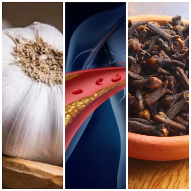 কোলেস্টেরল আমাদের শরীরের কার্যকারিতার জন্য অপরিহার্য, কিন্তু যখন এটি স্বাভাবিক মাত্রা ছাড়িয়ে যায়, তখন এটি হৃদযন্ত্রের জন্য হুমকিস্বরূপ। কোলেস্টেরল সীমা ছাড়িয়ে গেলে, এটি রক্তনালীতে জমা হতে পারে এবং ব্লকেজ, হৃদরোগ এবং স্ট্রোকের মতো গুরুতর রোগ সৃষ্টি করতে পারে। আজকের সময়ে, বিপুল সংখ্যক মানুষ উচ্চ কোলেস্টেরলের সমস্যায় ভুগছেন। আয়ুর্বেদে কোলেস্টেরলকে মেদ ধাতু বিকার বলা হয়। যখন শরীরে চর্বি বৃদ্ধি পায় এবং হজমের আগুন অর্থাৎ বিপাক দুর্বল হয়ে যায়, তখন ধমনীতে চর্বি জমা হতে শুরু করে।