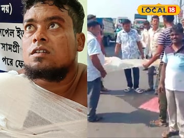 হরিহরপাড়ায় দুর্ঘটনায় আহত