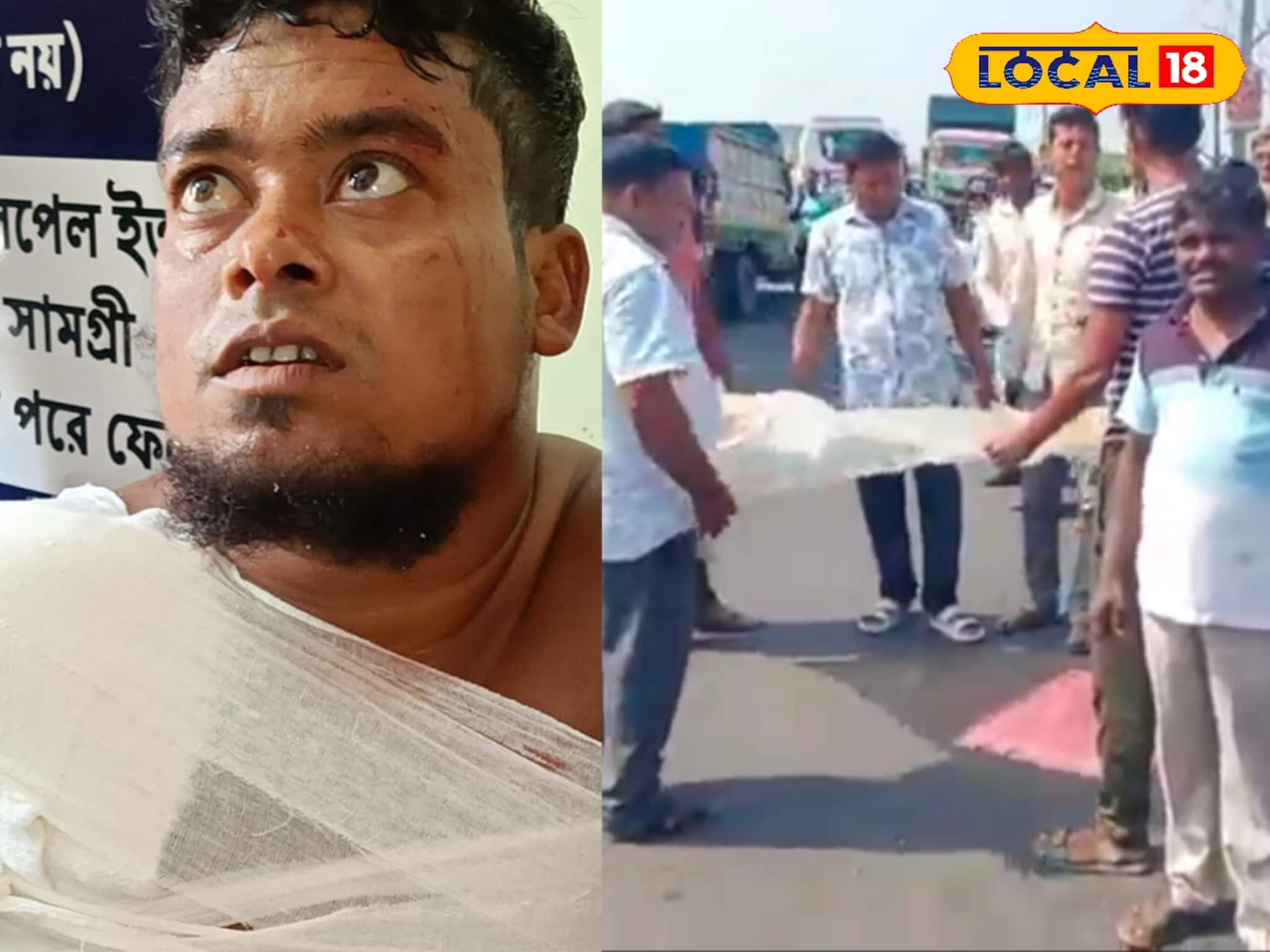 Bus Accident: চলন্ত বাসে ভয়াবহ দুর্ঘটনা! জানলা দিয়ে বের করা হাত কেটে পড়ল রাস্তায়