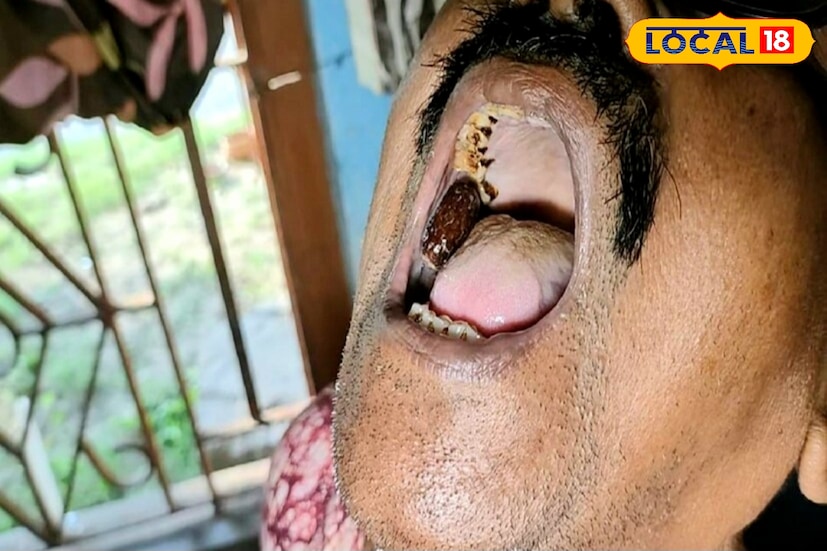 ভাইফোঁটার দিন আসলেই মন ভার হয়ে ওঠে অশোকনগর কচুয়া মোড় এলাকার বাসিন্দা জয়দেব বিশ্বাসের। প্রায় ২৯ বছর আগে ভাই ফোঁটার দিনই, বোনের কথা রাখতে দাদা জয়দেব মুখে নিয়েছিলেন একটি জলপাইয়ের আঁটি। ১৩ বছর আগে সেই বোন মারা গিয়েছেন। বোনের স্মৃতি ধরে রাখতে দাদা আজও মুখের মধ্যে রেখে দিয়েছেন ওই জলপাইয়ের আঁটি