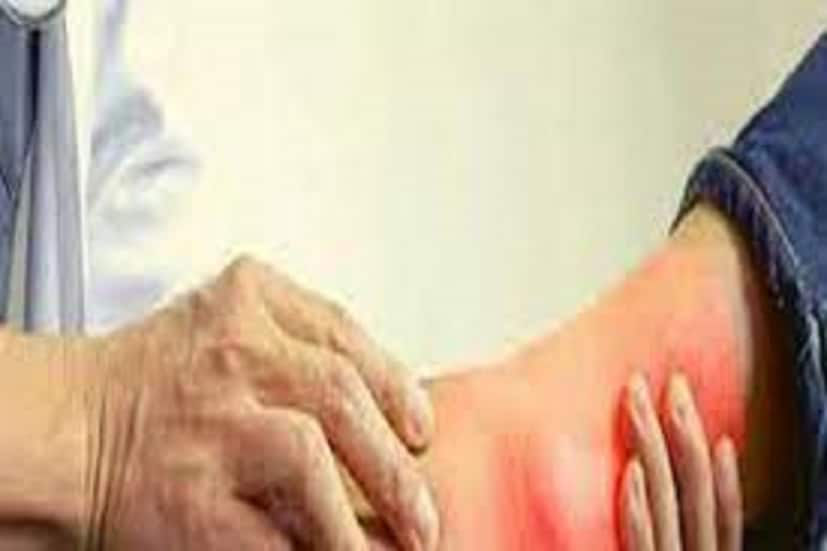 চেরি একটি ছোট ফল এক অনেক সুবিধা, ইউরিক অ্যাসিড নিয়ন্ত্রিত করলে সব থেকে ভাল ফল পাবেন ৷ ইউরিক অ্যাসিড কম করতে বিশেষ ভাবে কাজে লাগে ৷ প্রতীকী ছবি ৷ 