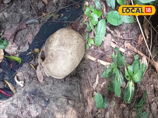 লালগড়ের জঙ্গল থেকে উদ্ধার মানুষের কঙ্কাল