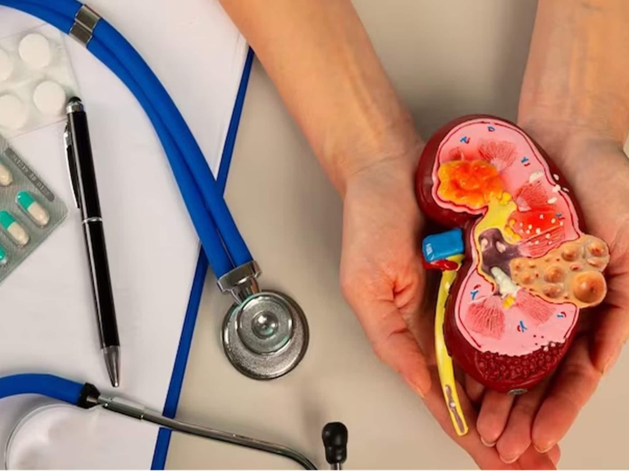 Creatinine:ক্রিয়েটিনিন বাড়া মানেই নষ্ট হচ্ছে কিডনি, কম প্রোটিন খাওয়ার মতো সহজ কয়েকটা অভ্যাসেই বশে ক্রিয়েটিনিন