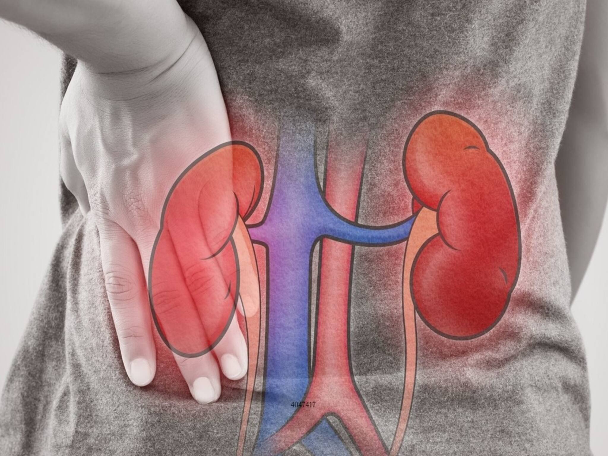 Kidney Damage: এই ৭ কারণে ক্ষতি হয় কিডনির, অভ্যাসগুলোর একটাও আপনার নেই তো?