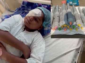এই শব্দবাজি দুঃস্বপ্নের মতো হয়ে উঠেছে তাদের বাবা মা এবং ডাক্তারদের কাছে