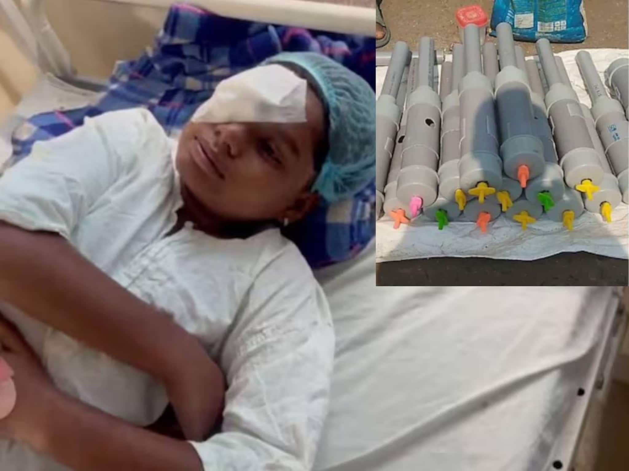 Diwali Carbide Gun: বাজির নামে বোমা বিস্ফোরণের মরণফাঁদ! ‘কার্বাইড গান’ ফাটাতে গিয়ে দৃষ্টিশক্তি হারাল ১৪ জন শিশু! চোখের সমস্যায় আক্রান্ত ১২২ খুদে!