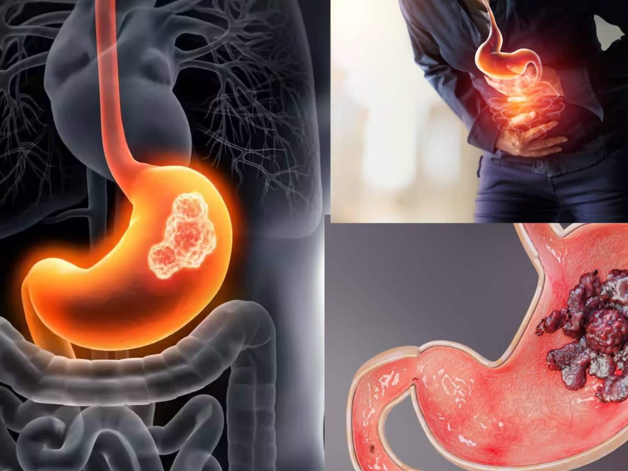 Stomach Cancer & Ulcer: রোজ এই ফল জাস্ট ‘২ টো’! পেটের আলসার, ক্যানসারের মহৌষধ! এই ফল পাকস্থলীর প্রাকৃতিক পাহারাদার!