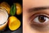 নামীদামি ক্রিম, লোশন গোল্লায় যাক! আলুর রসে ‘এটা’ মিশিয়ে লাগালেই উধাও হবে চোখের নীচের কালি