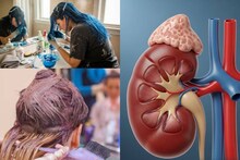 হেয়ার কালার কিডনির জন্য বিষাক্ত? চুলে রং দিলেই ঝাঁঝরা কিডনি? কিডনির অসুখের লক্ষণ জানুন